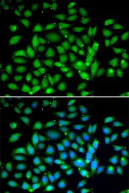 Immunofluorescence - MECP2 antibody (A13328)