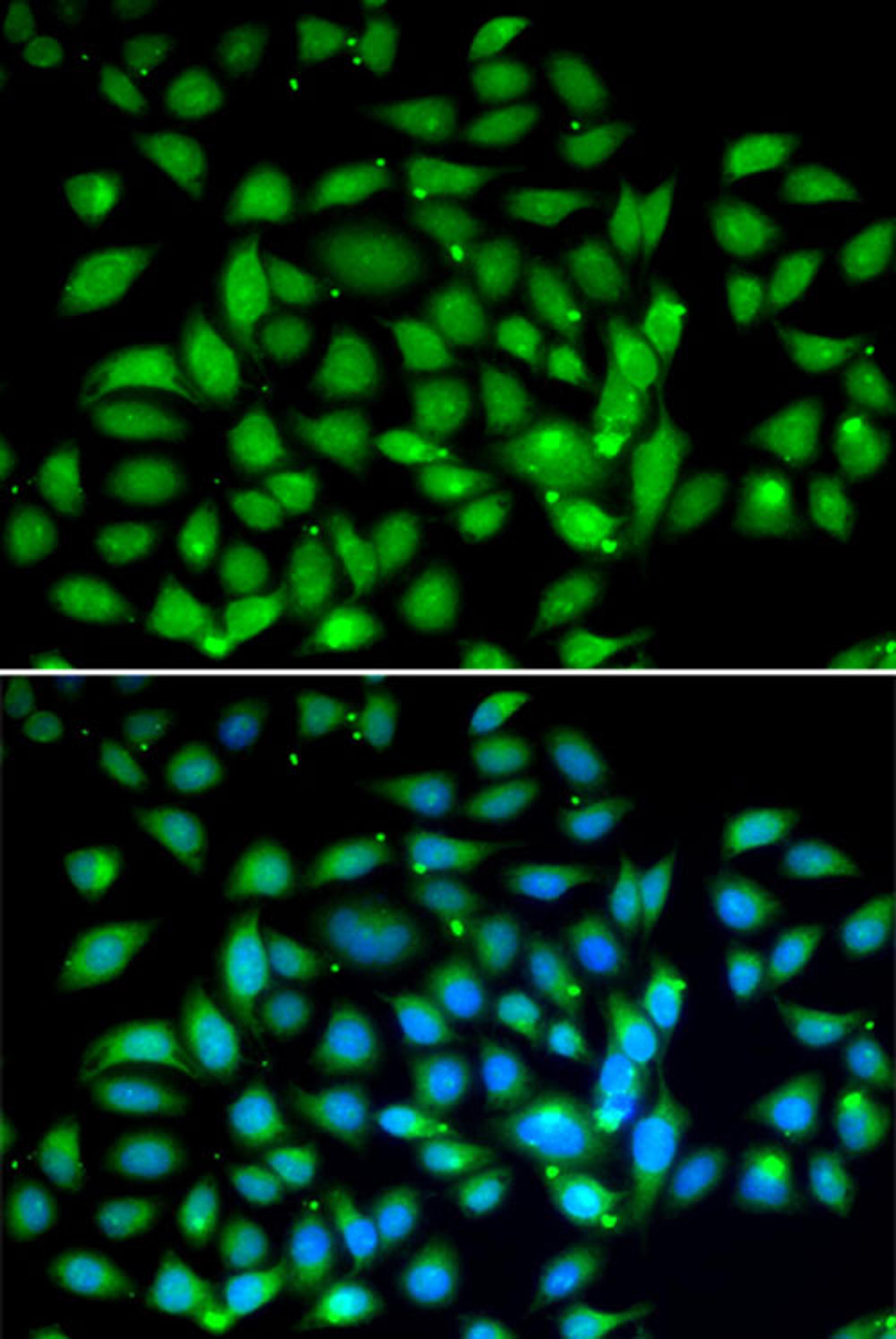 Immunofluorescence - MECP2 antibody (A13328)