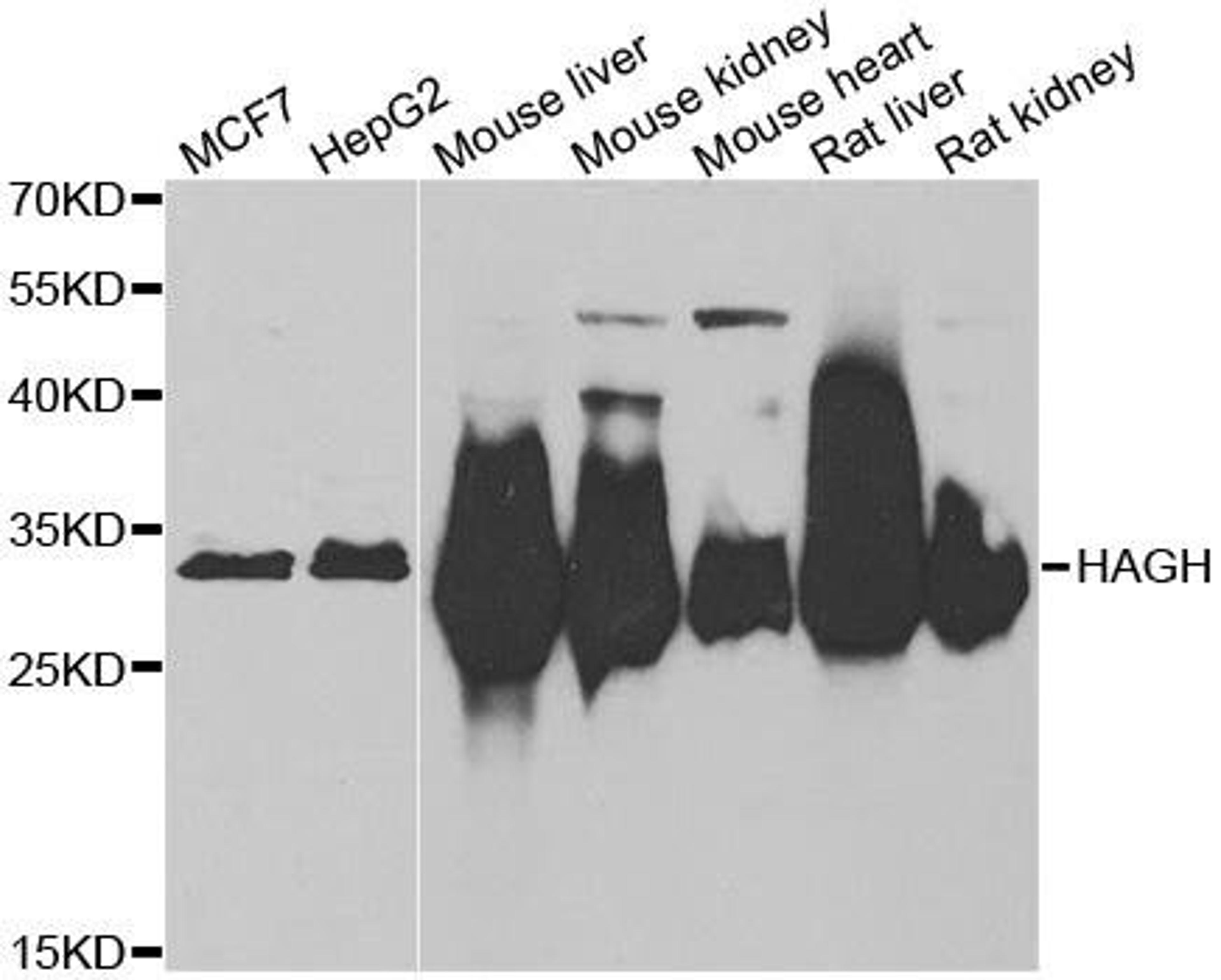 Western blot analysis of extracts of various cell lines using HAGH antibody