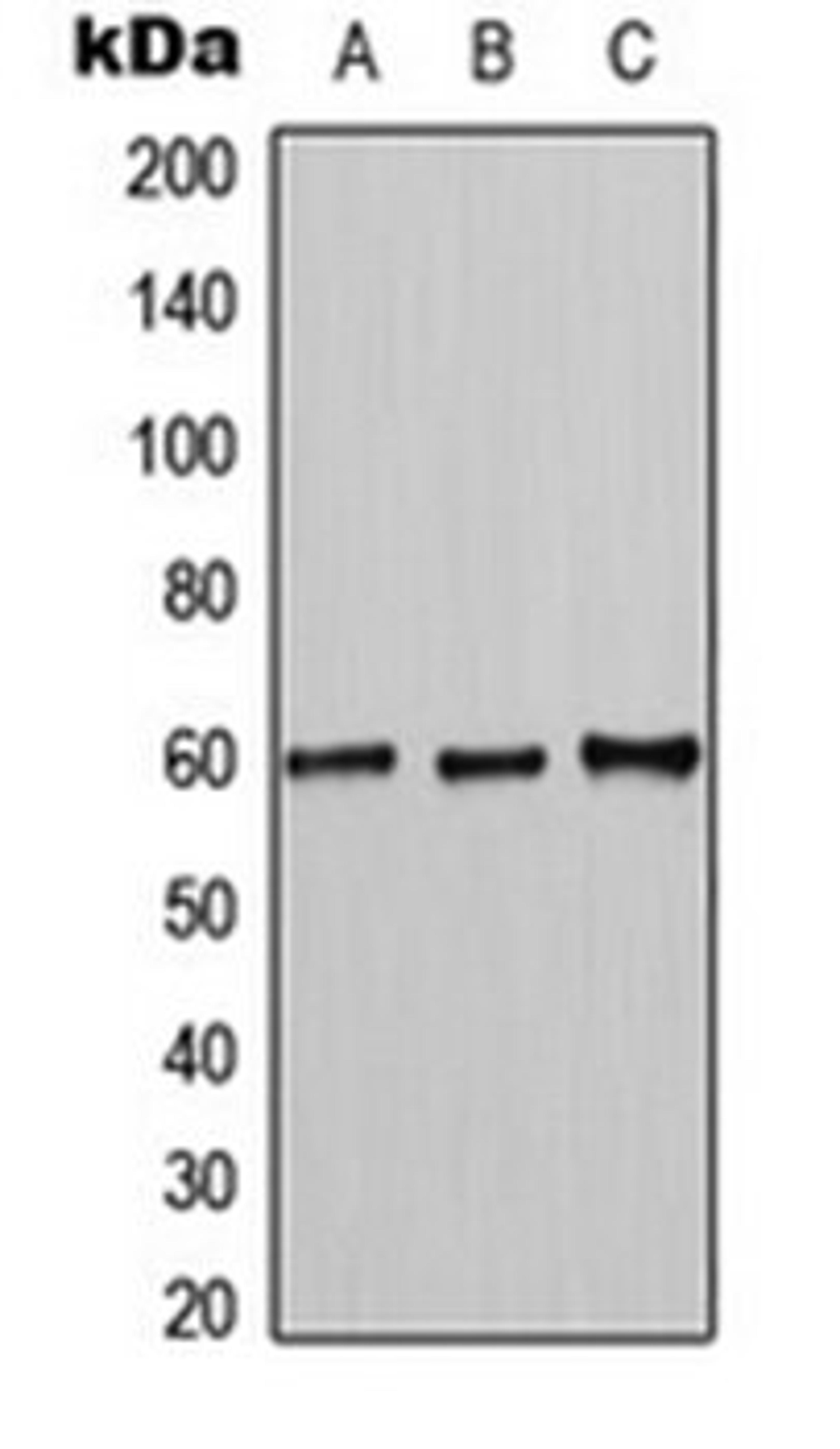 Western blot analysis of K562 (Lane 1), HL60 (Lane 2), NIH3T3 (Lane 3) whole cell lysates using MUTYH antibody