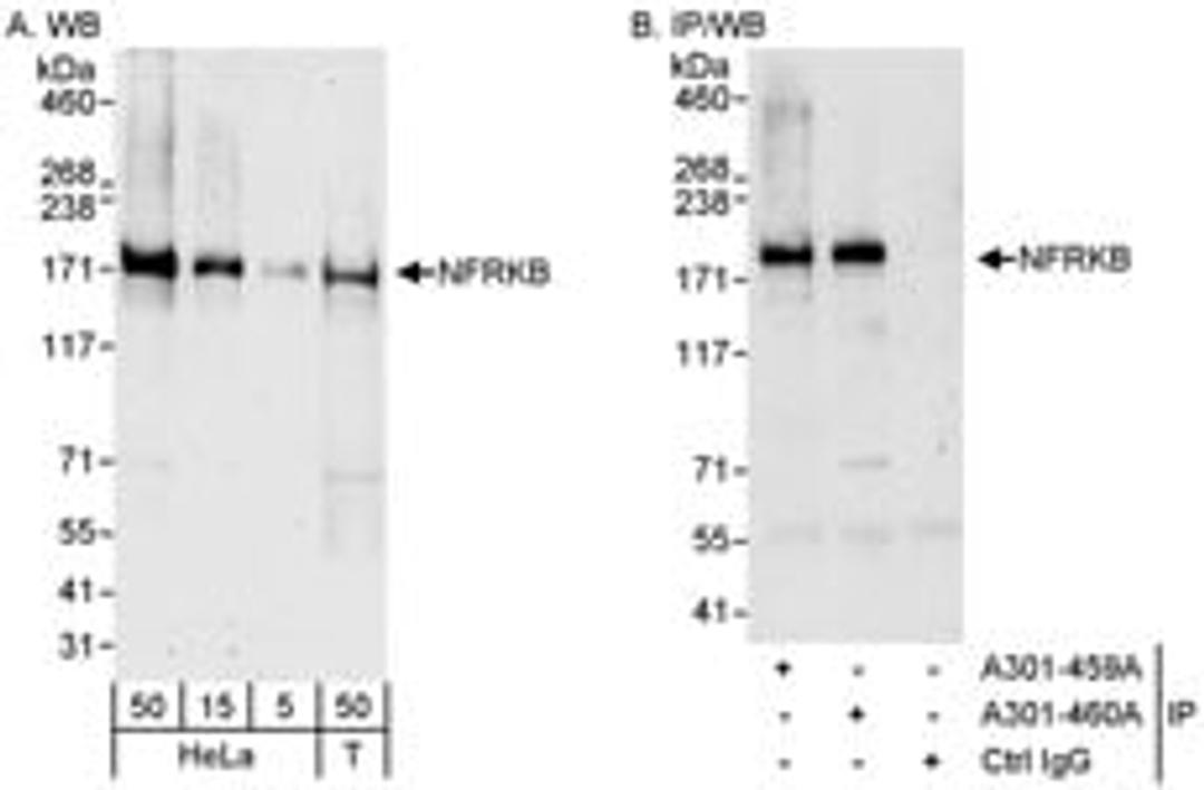 Detection of human NFRKB by western blot and immunoprecipitation.