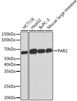 Western blot - PAR2 Rabbit mAb (A5103)