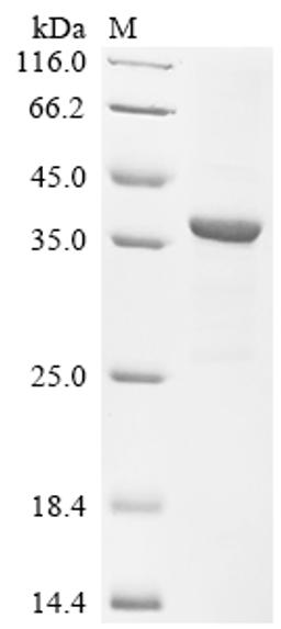 (Tris-Glycine gel) Discontinuous SDS-PAGE (reduced) with 5% enrichment gel and 15% separation gel.