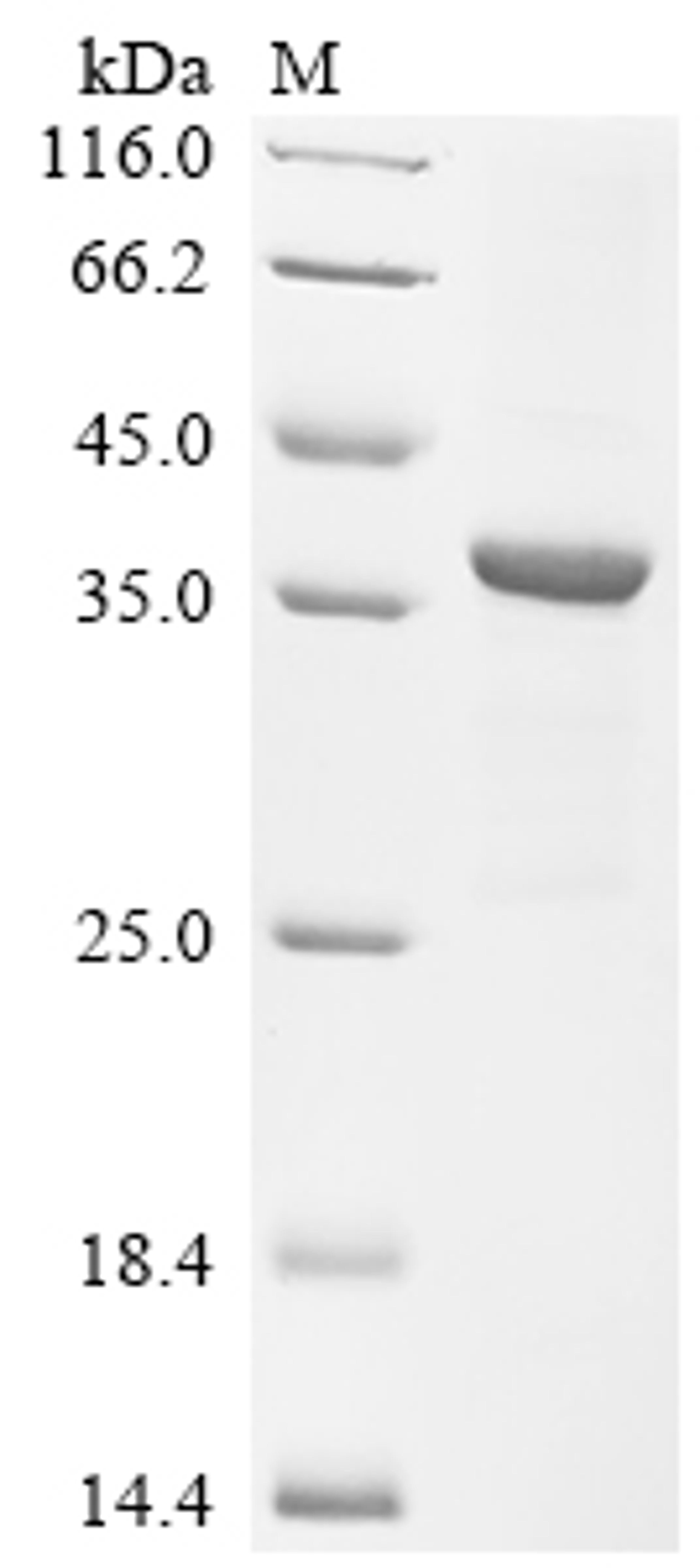 (Tris-Glycine gel) Discontinuous SDS-PAGE (reduced) with 5% enrichment gel and 15% separation gel.