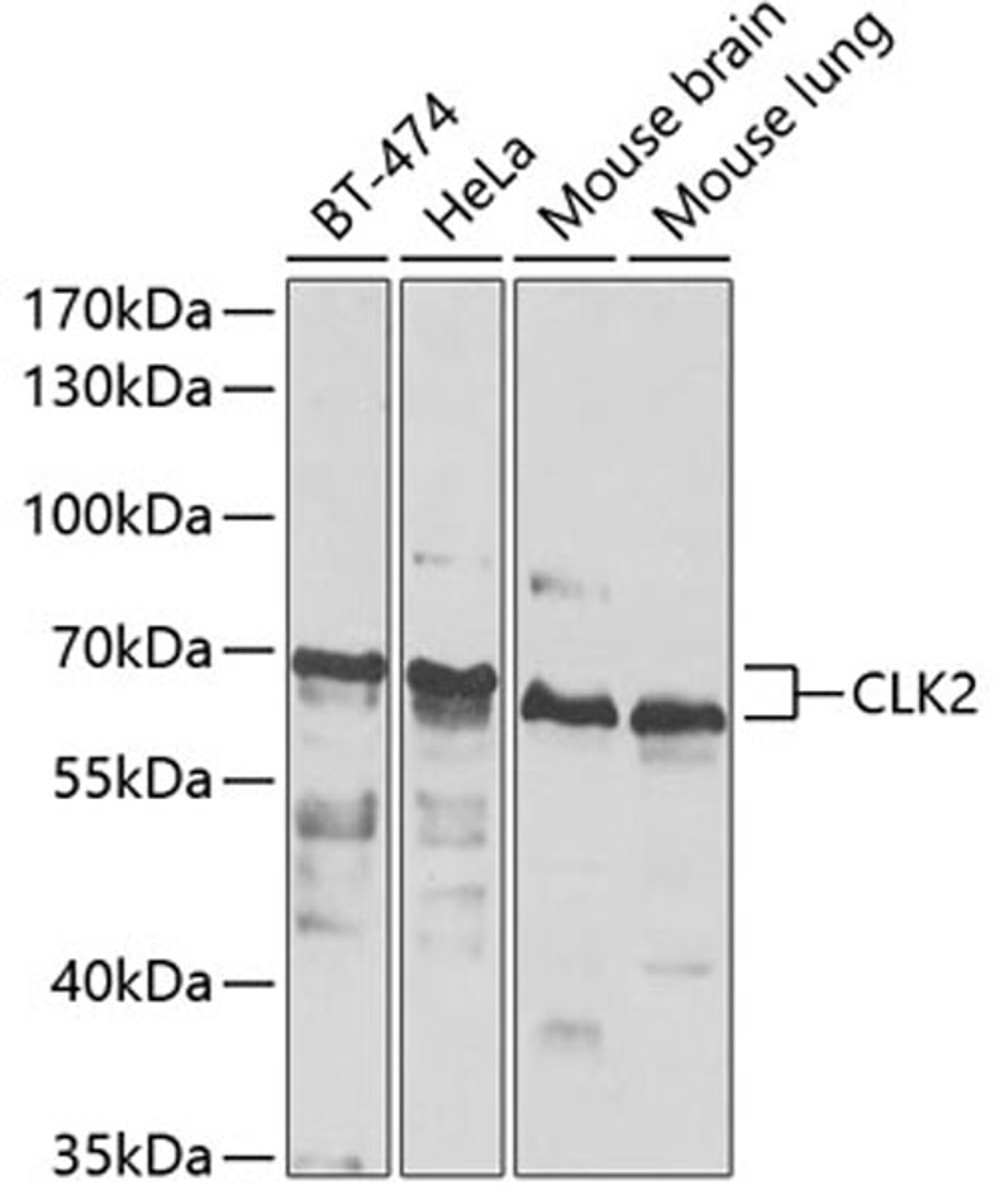 Western blot - CLK2 antibody (A7885)