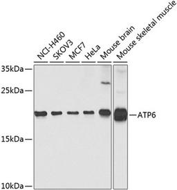 Western blot - ATP6 antibody (A8193)