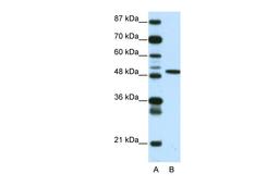 Antibody used in WB on Human 293T at 0.2-1 ug/ml.