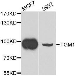 WB analysis of extracts of various cell lines using TGM1 antibody