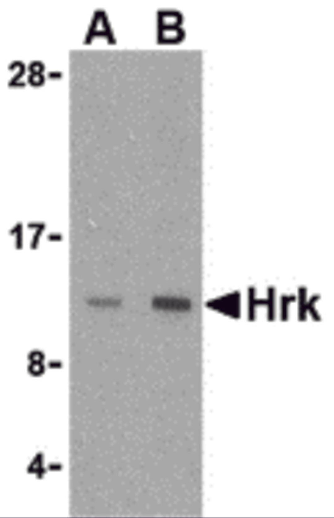 Western blot analysis of Hrk in mouse pancreas tissue lysate with Hrk antibody at (A) 2.5 and (B) 5 μg/mL.