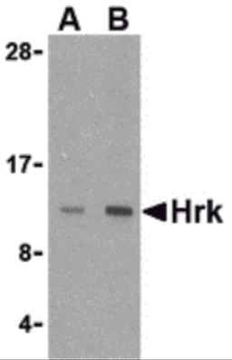 Western blot analysis of Hrk in mouse pancreas tissue lysate with Hrk antibody at (A) 2.5 and (B) 5 μg/mL.