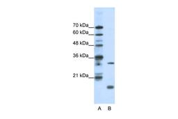 Antibody used in WB on Human HepG2 at 1.25 ug/ml.