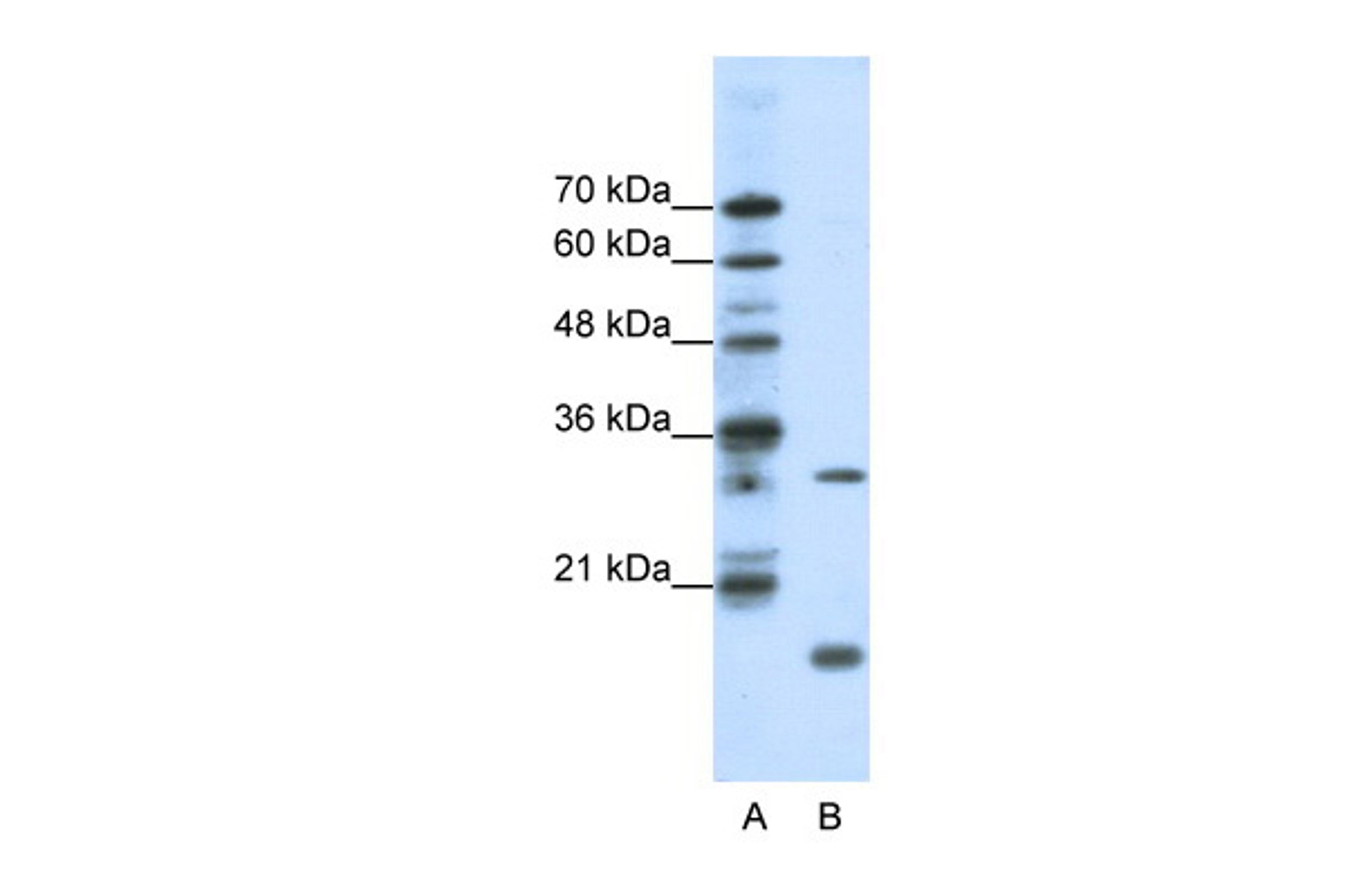 Antibody used in WB on Human HepG2 at 1.25 ug/ml.