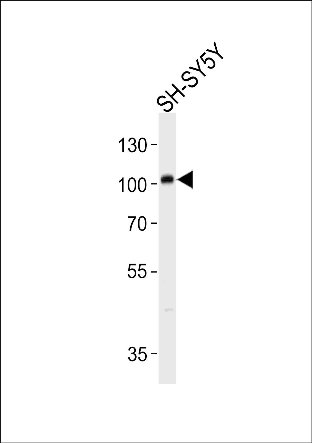 Western blot analysis in SH-SY5Y cell line lysates (35ug/lane).