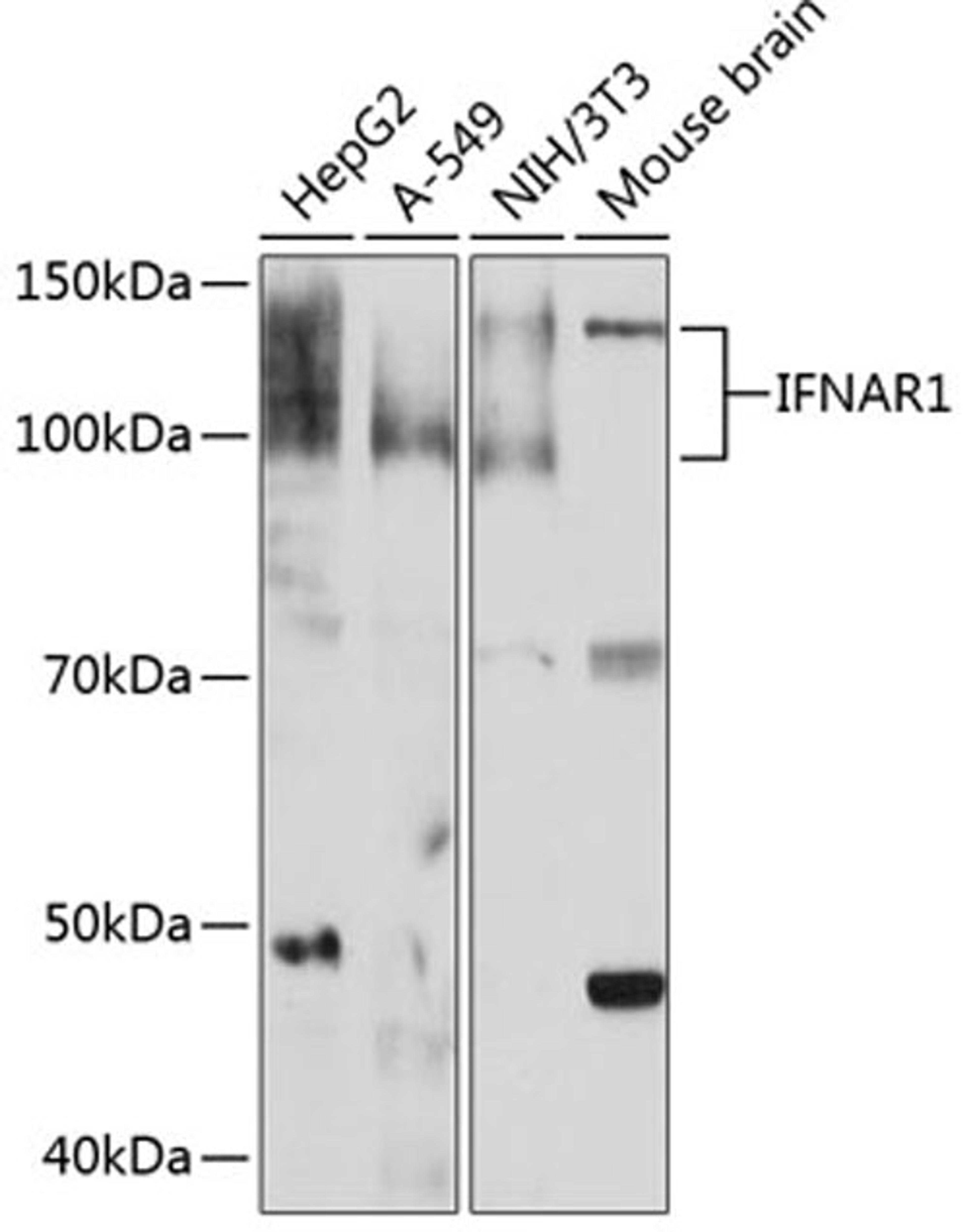 Western blot - IFNAR1 Rabbit mAb (A0575)