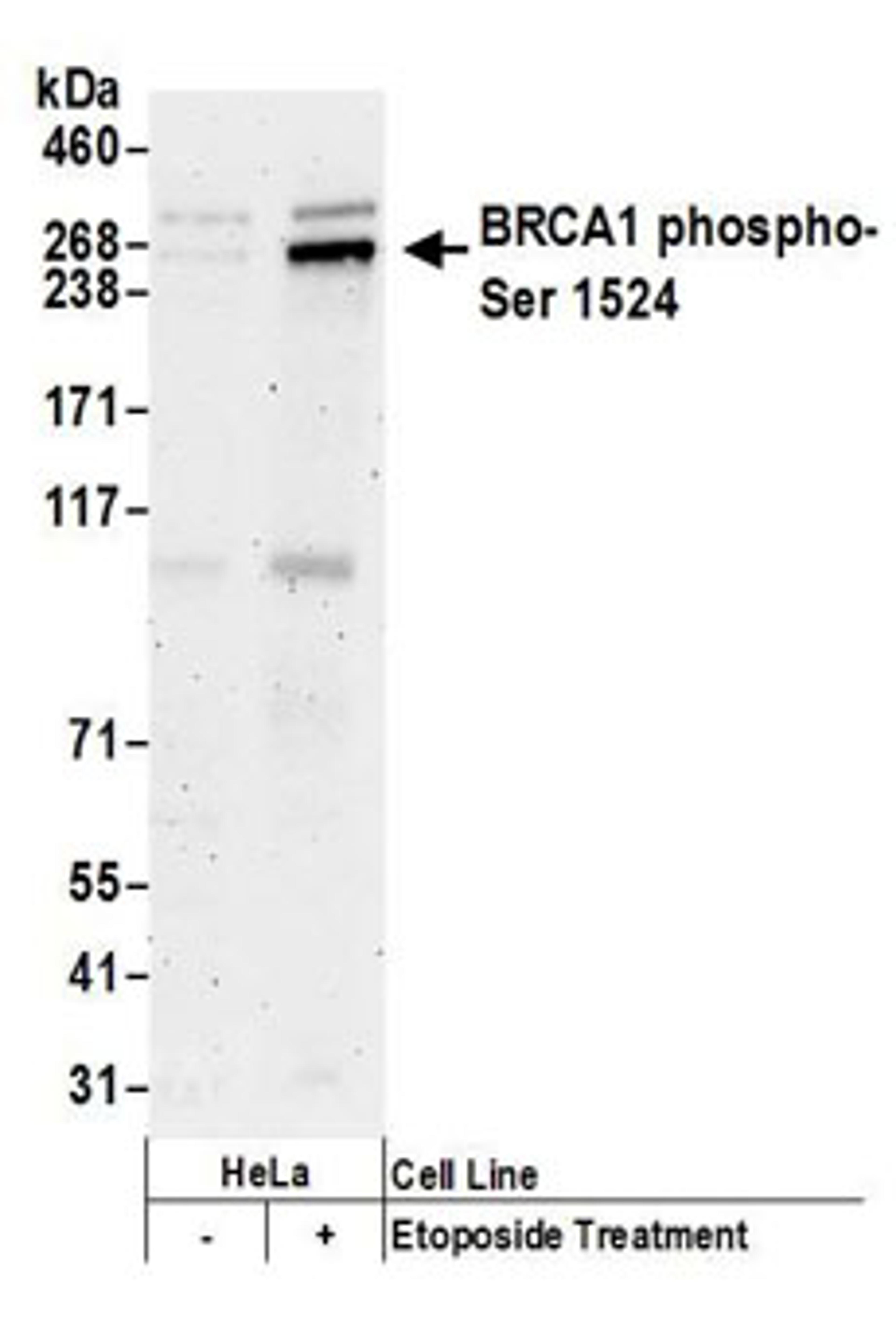 Detection of human Phospho BRCA1 (S1524) by western blot.