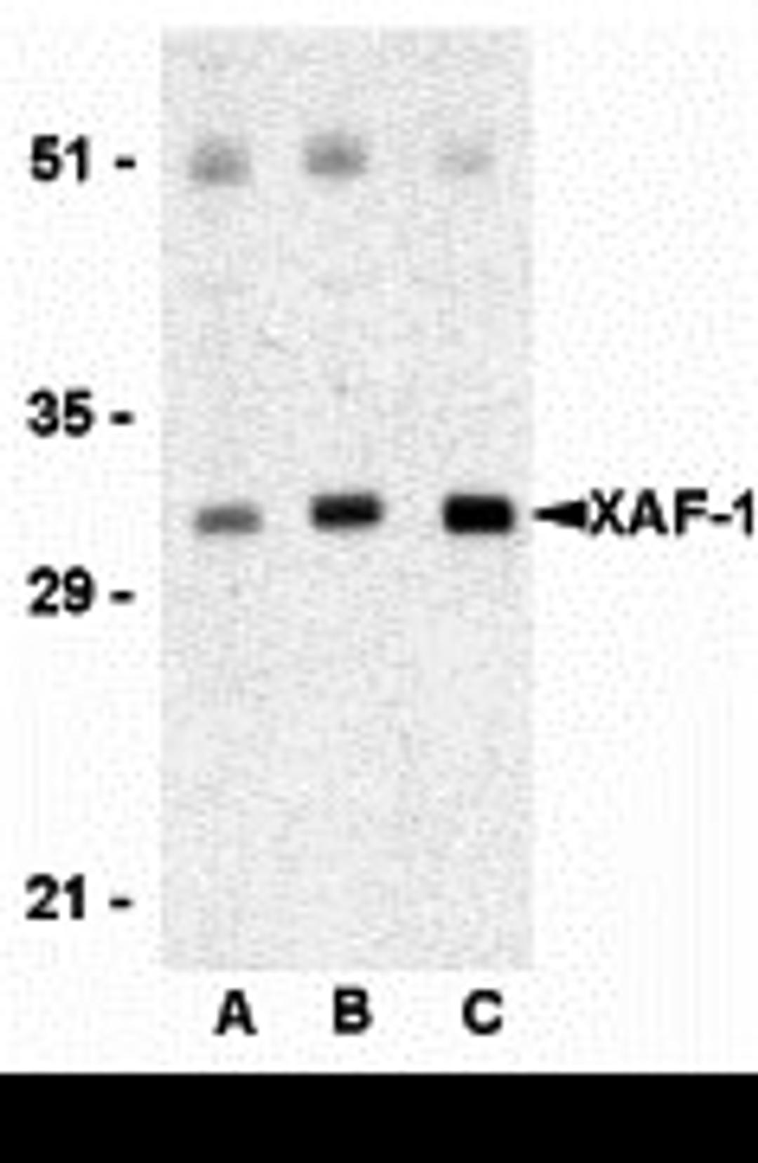 Western blot analysis of XAF-1 in human spleen lysate with XAF-1 antibody at (A) 0.5 , (B) 1 , and (C) 2 μg/mL, respectively.