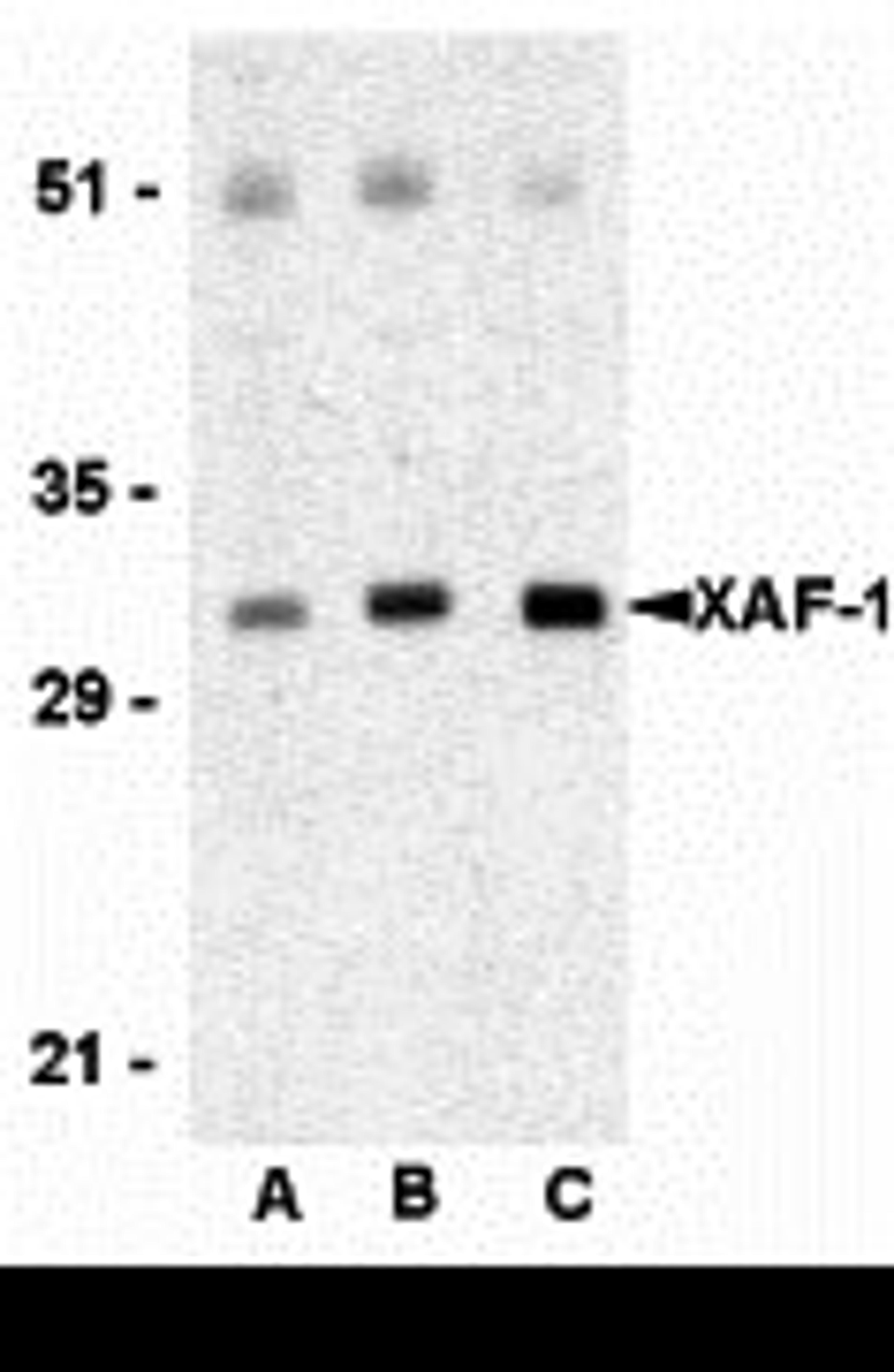 Western blot analysis of XAF-1 in human spleen lysate with XAF-1 antibody at (A) 0.5 , (B) 1 , and (C) 2 μg/mL, respectively.