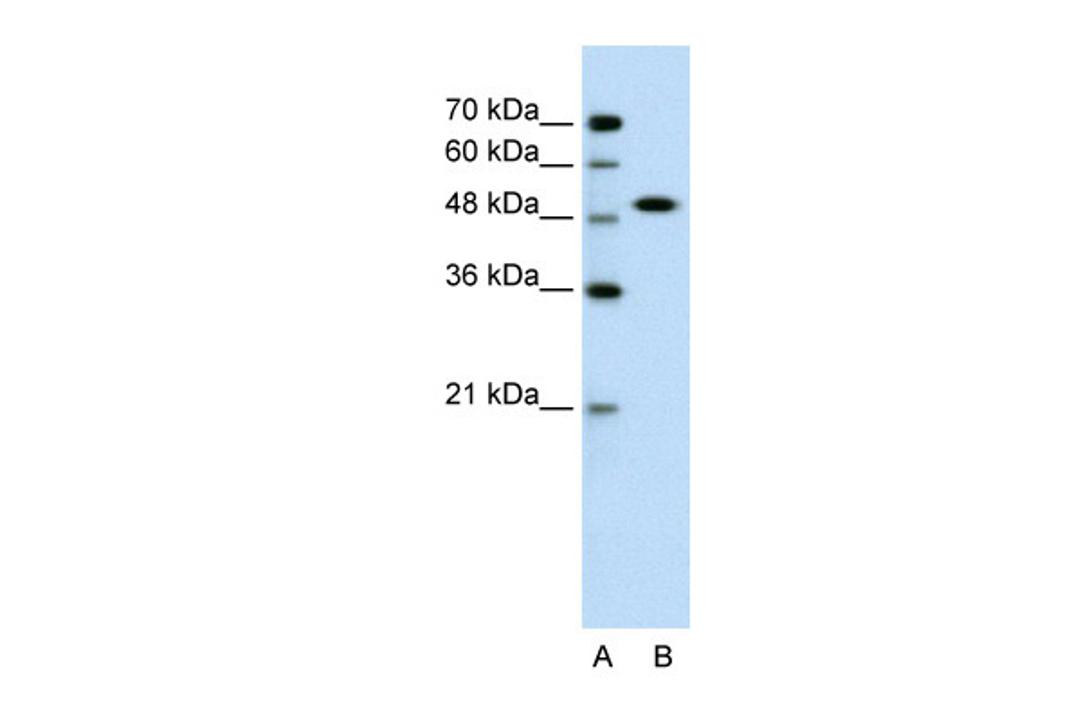 Antibody used in WB on Human Jurkat 0.2-1 ug/ml.