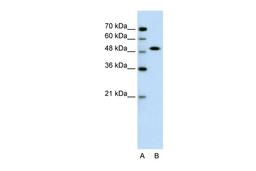 Antibody used in WB on Human Jurkat 0.2-1 ug/ml.