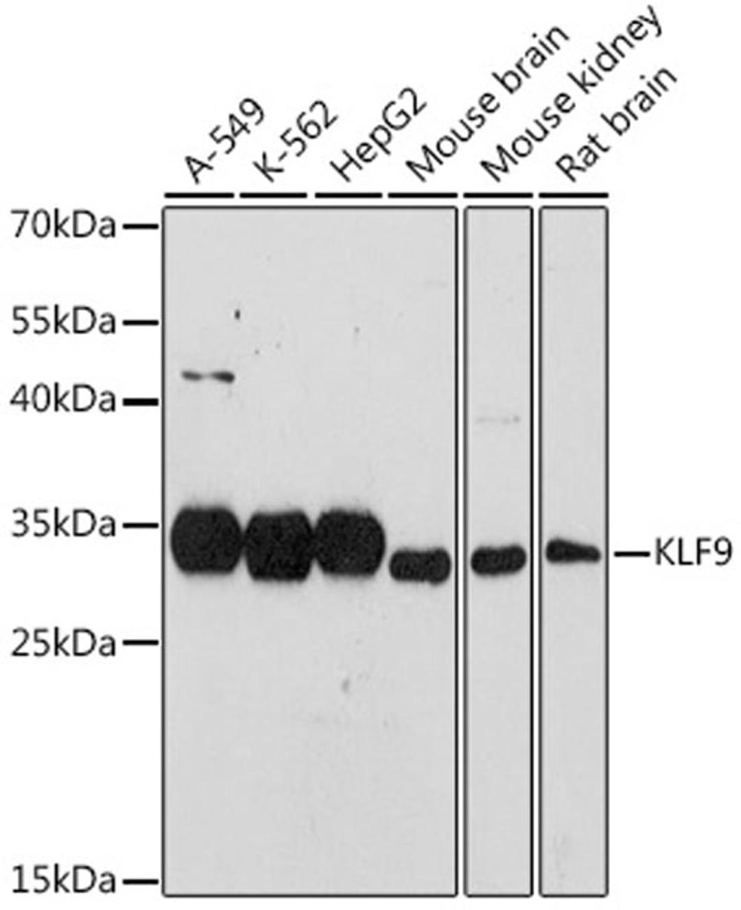 Western blot - KLF9 antibody (A7196)