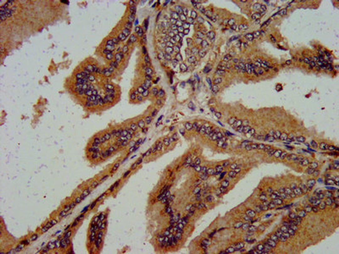IHC image of CSB-PA620971LA01HU diluted at 1:600 and staining in paraffin-embedded human prostate tissue performed on a Leica BondTM system.