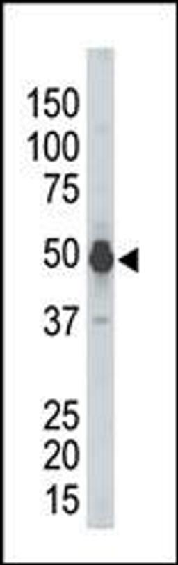 Antibody is used in Western blot to detect PHKG2 in mouse kidney tissue lysate.