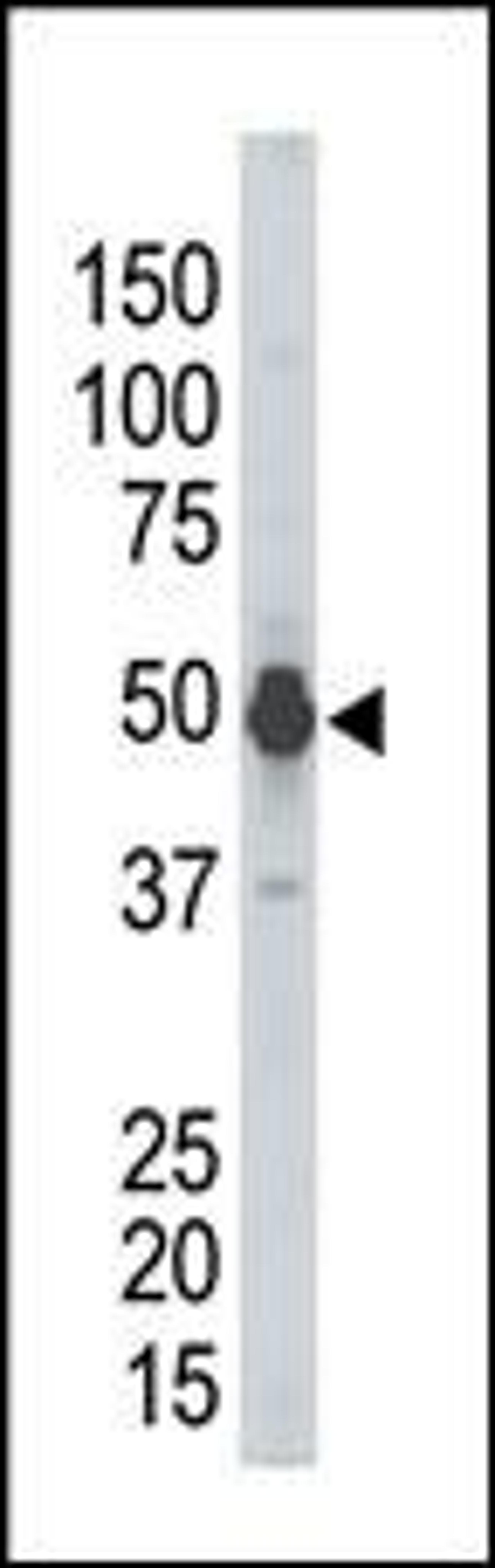 Antibody is used in Western blot to detect PHKG2 in mouse kidney tissue lysate.