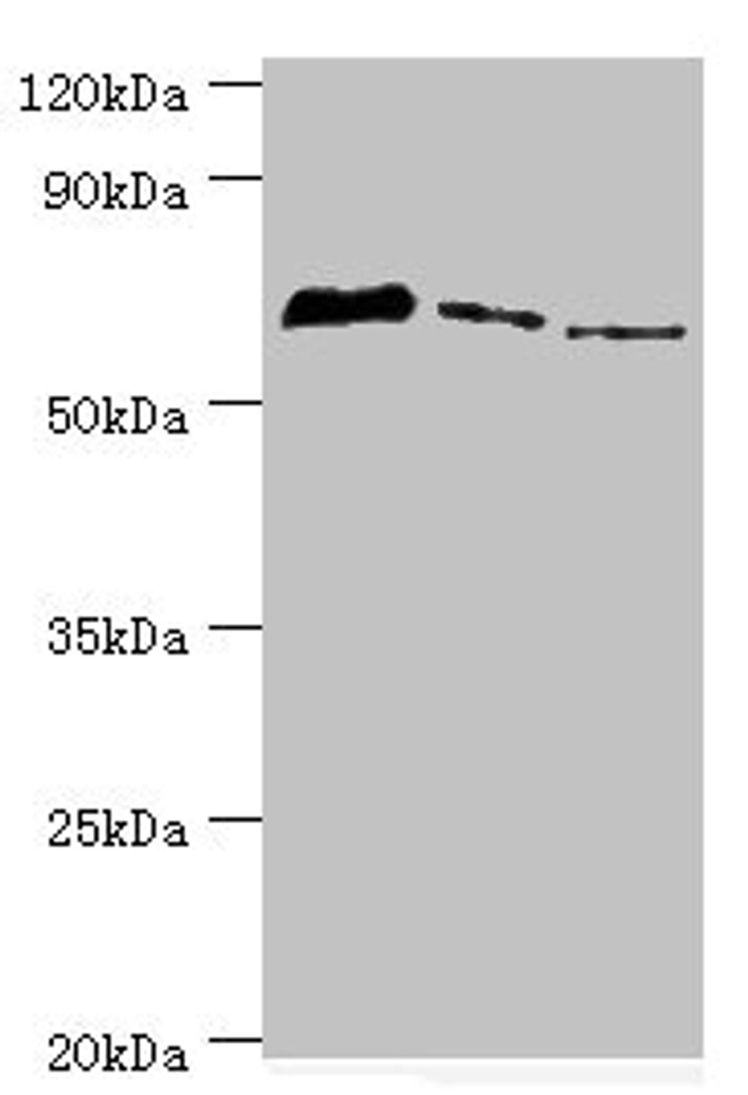 Western blot. All lanes: Tyrosyl-DNA phosphodiesterase 1 antibody at 8ug/ml. Lane 1: MCF-7 whole cell lysate. Lane 2: Mouse lung tissue. Lane 3: Rat brain tissue. Secondary. Goat polyclonal to rabbit IgG at 1/10000 dilution. Predicted band size: 69, 42 kDa. Observed band size: 69 kDa.