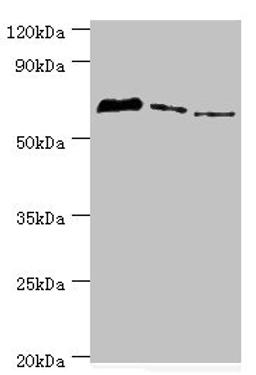 Western blot. All lanes: Tyrosyl-DNA phosphodiesterase 1 antibody at 8ug/ml. Lane 1: MCF-7 whole cell lysate. Lane 2: Mouse lung tissue. Lane 3: Rat brain tissue. Secondary. Goat polyclonal to rabbit IgG at 1/10000 dilution. Predicted band size: 69, 42 kDa. Observed band size: 69 kDa.