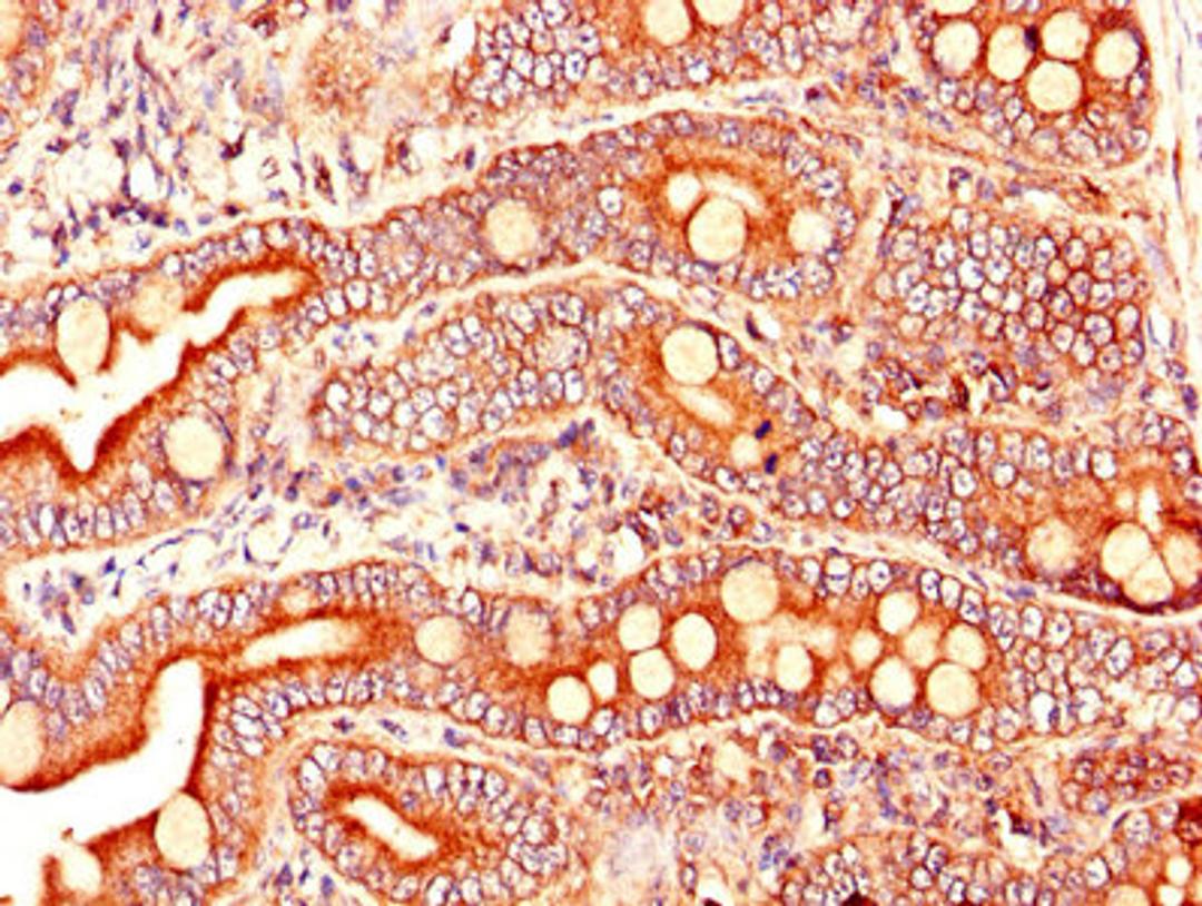 Immunohistochemistry of paraffin-embedded human small intestine tissue using CSB-PA002096LA01HU at dilution of 1:100