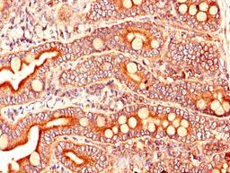 Immunohistochemistry of paraffin-embedded human small intestine tissue using CSB-PA002096LA01HU at dilution of 1:100