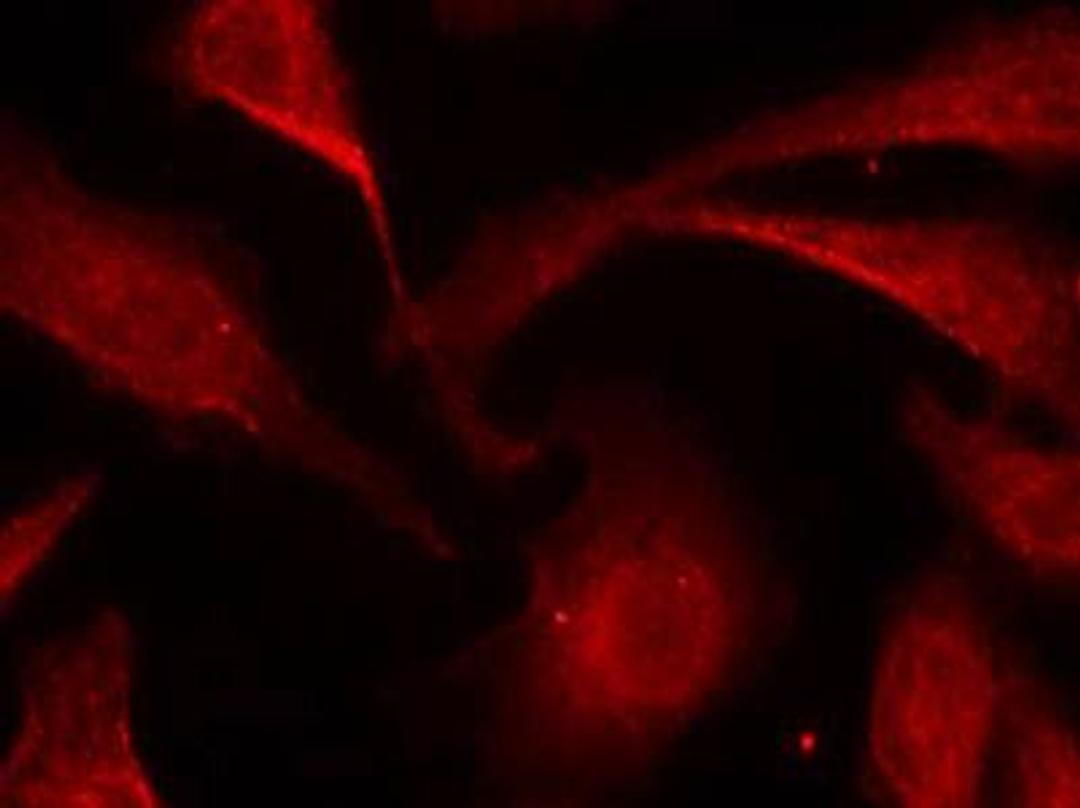 Confocal immunofluorescent analysis of Hela cells using NFkB-p65(Phospho-Ser529) antibody