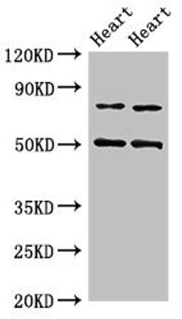 Western Blot. Positive WB detected in: Rat heart tissue, Mouse heart tissue. All lanes: Acss2 antibody at 4ug/ml. Secondary. Goat polyclonal to rabbit IgG at 1/50000 dilution. Predicted band size: 79 kDa. Observed band size: 79, 50 kDa. 