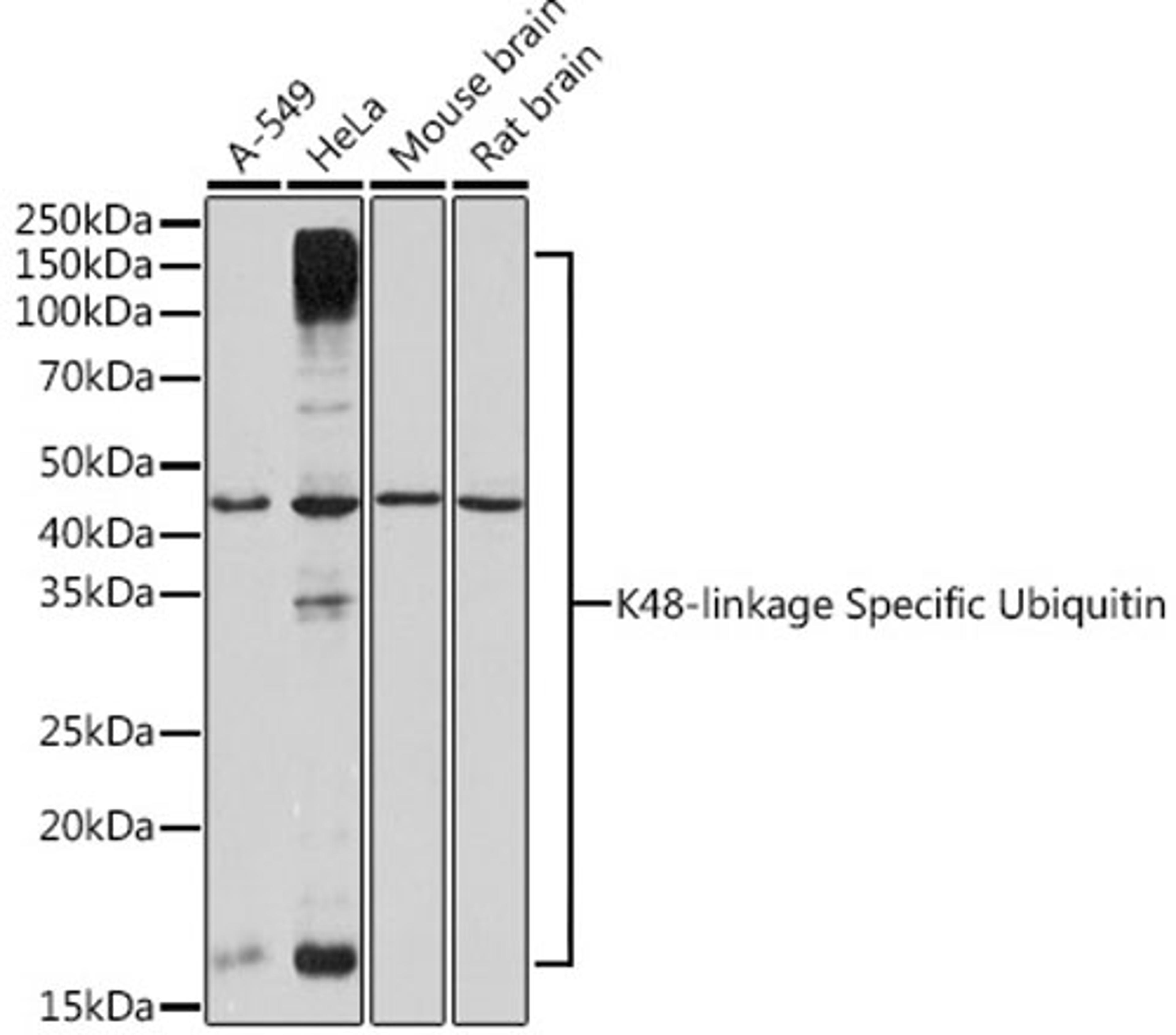 Western blot - K48-linkage Specific Ubiquitin Rabbit mAb (A3606)