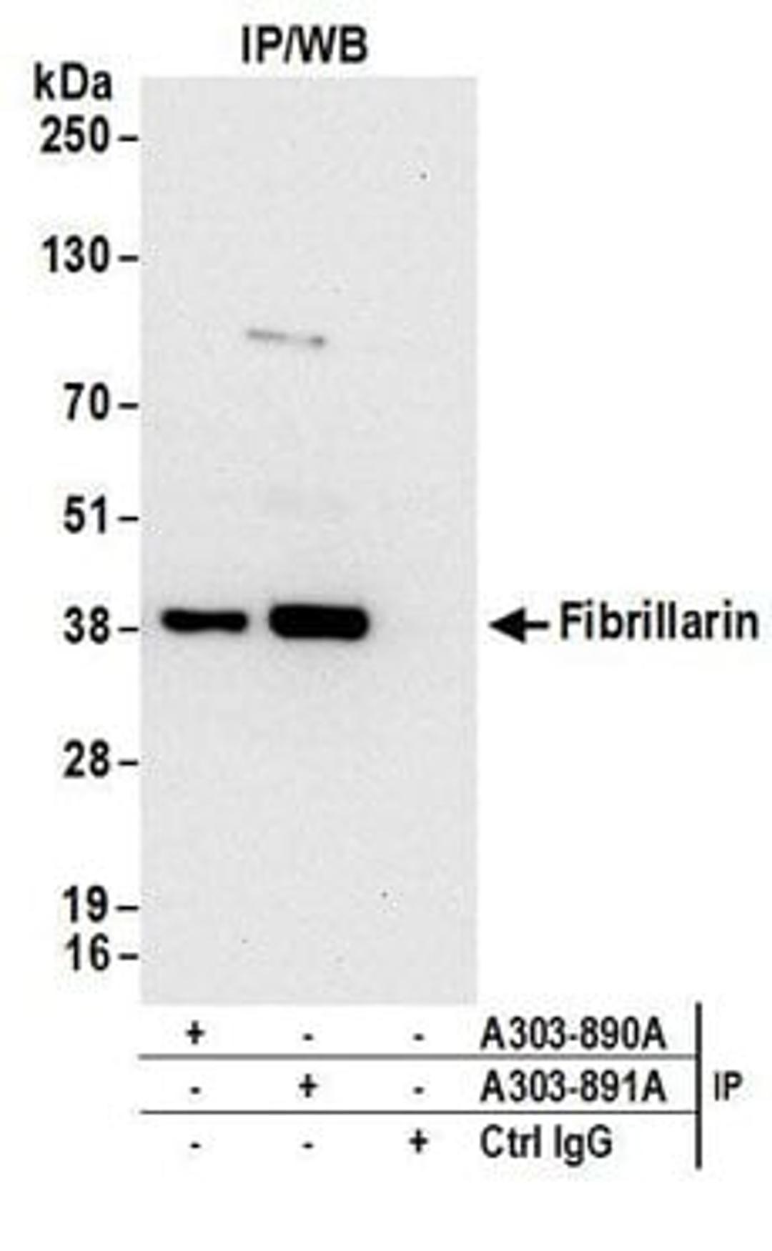 Detection of human Fibrillarin by western blot of immunoprecipitates.