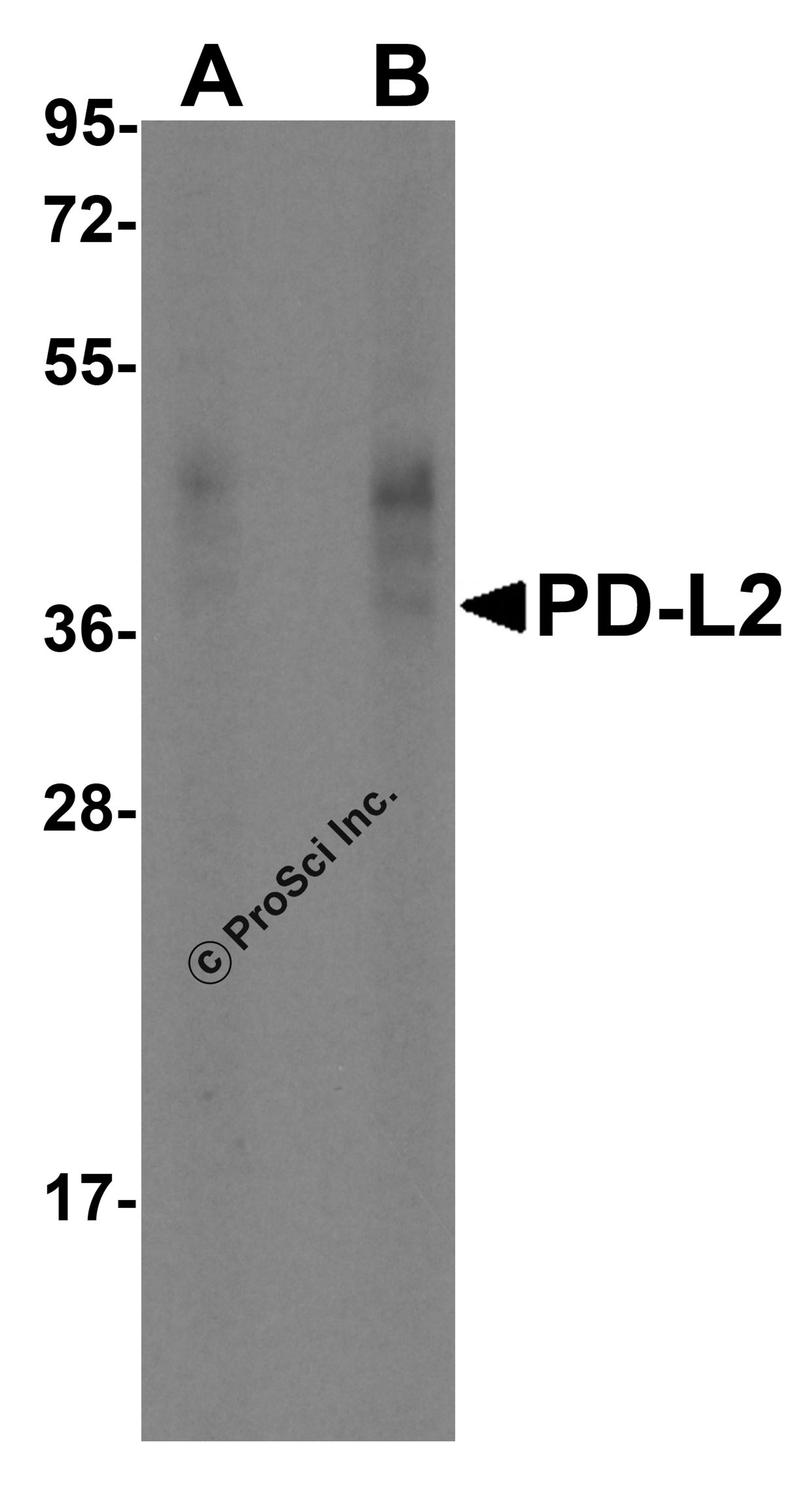 Western blot analysis of PD-L2 in overexpressing HEK293 cells PD-L2 antibody at 0.5 and 1 &#956;g/ml