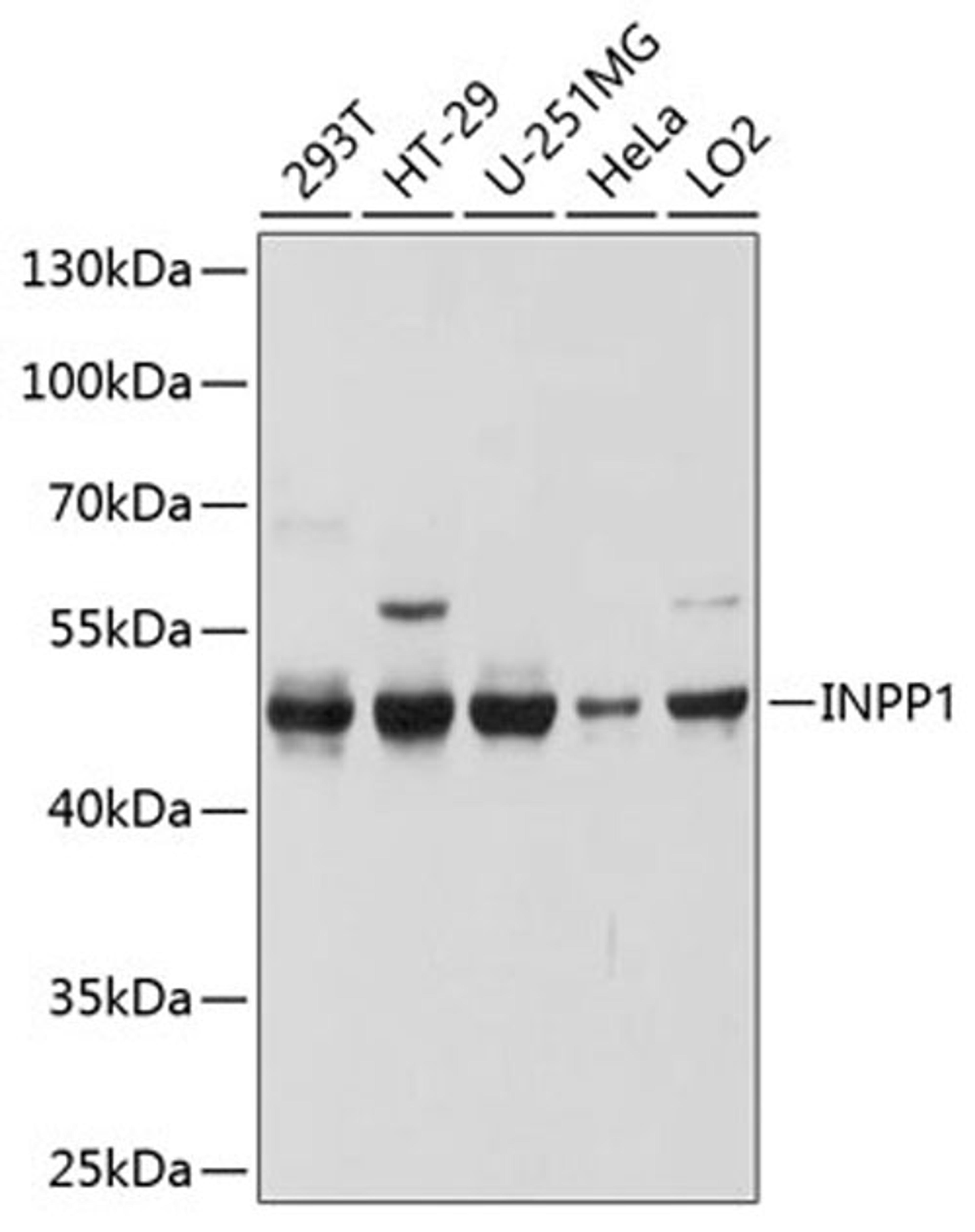 Western blot - INPP1 antibody (A10372)