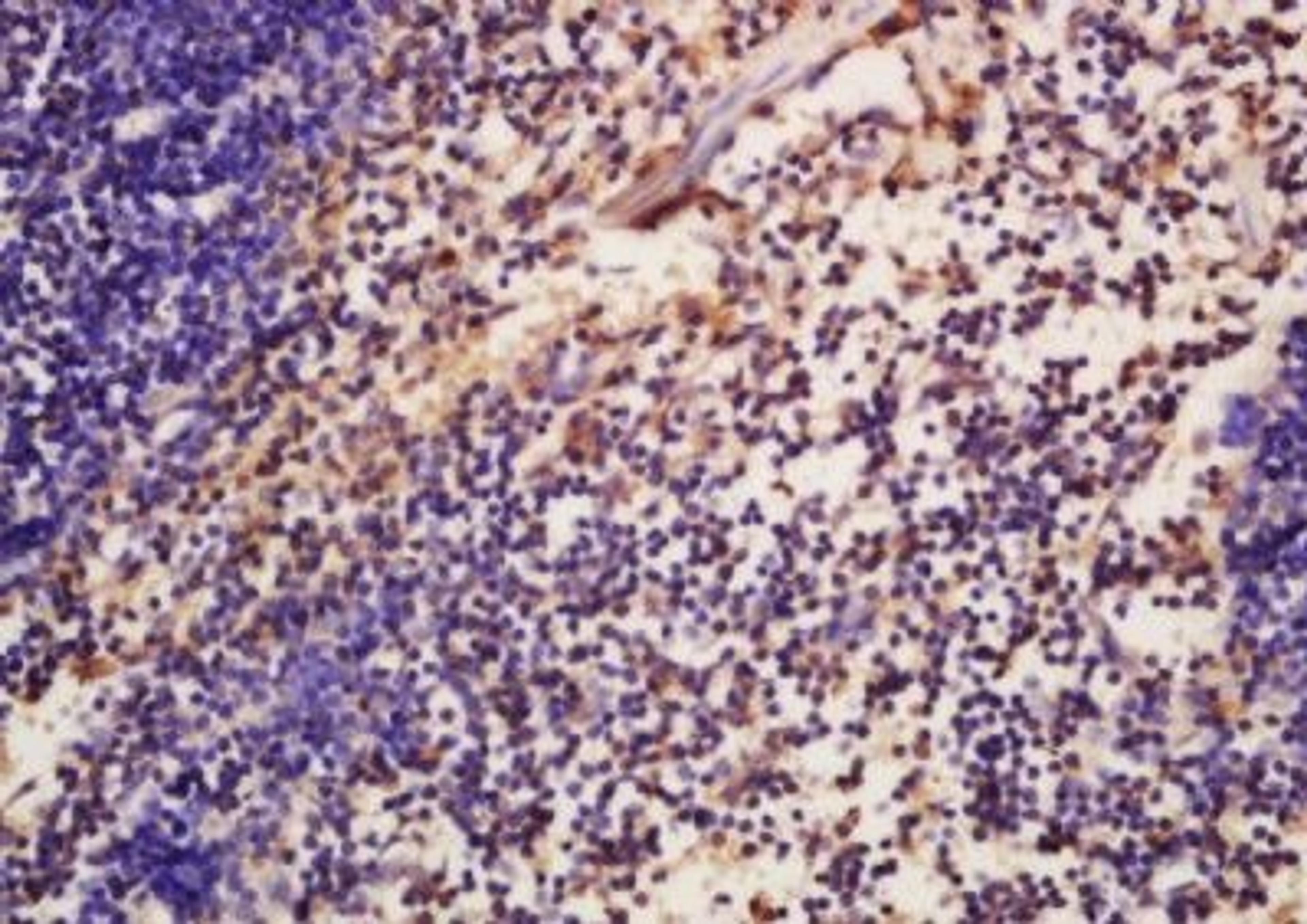 Immunohistochemical analysis of formalin-fixed paraffin embedded mouse spleen tissue using ATG16A (phospho-Ser287) antibody (dilution at 1:200)