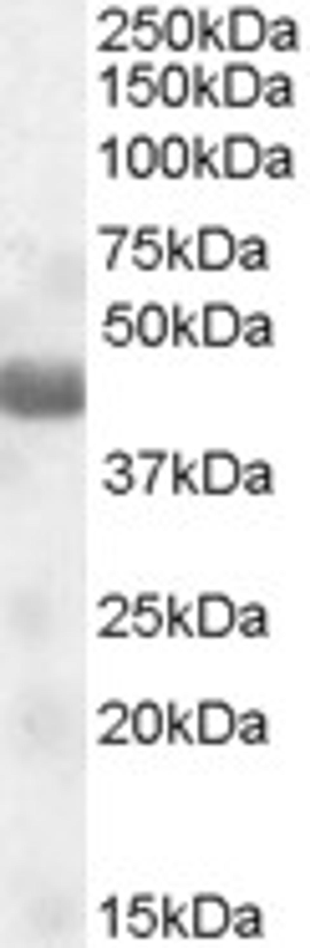 46-539 (0.1ug/ml) staining of Human Muscle lysate (35ug protein in RIPA buffer). Primary incubation was 1 hour. Detected by chemiluminescence.