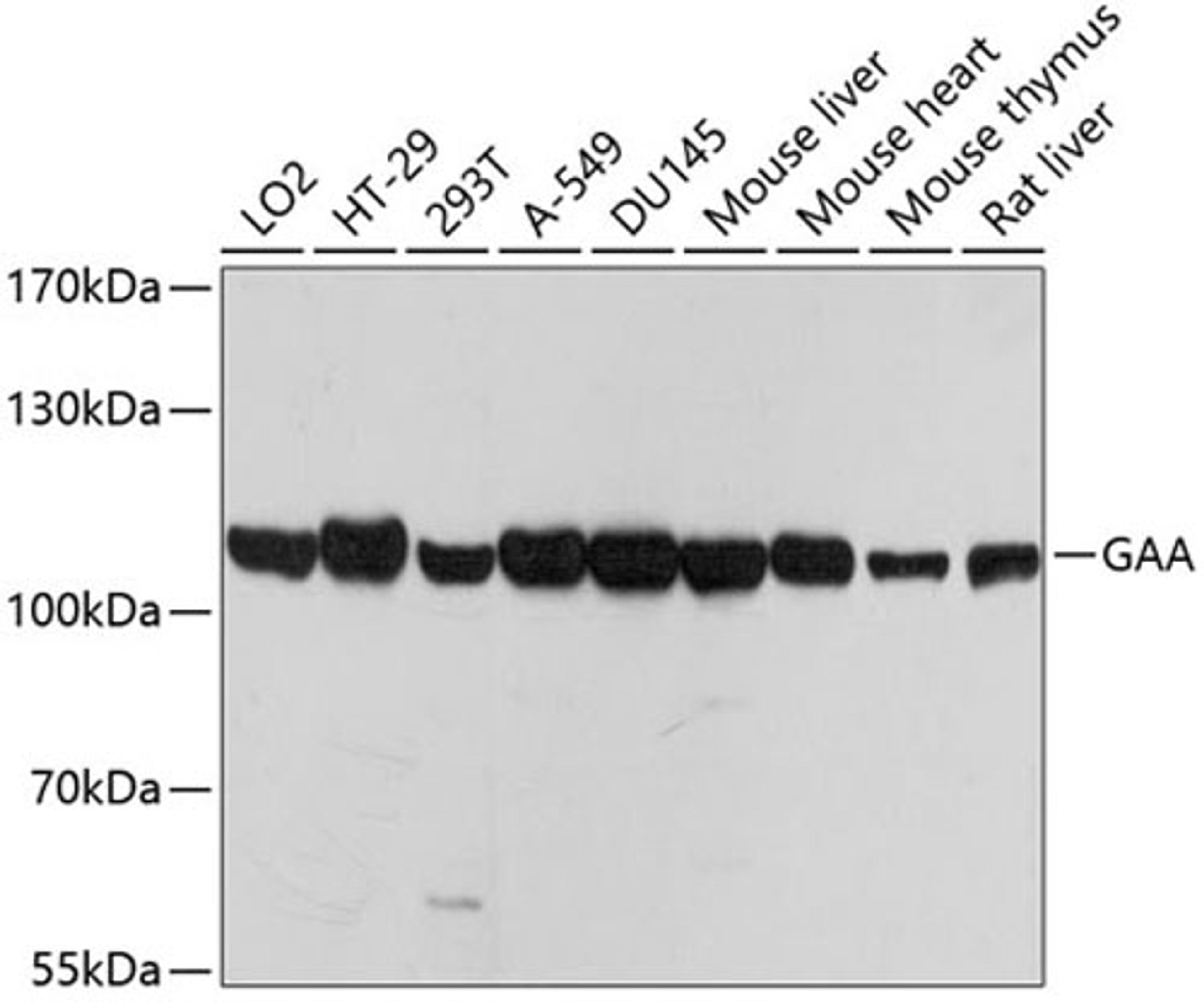 Western blot - GAA antibody (A7674)