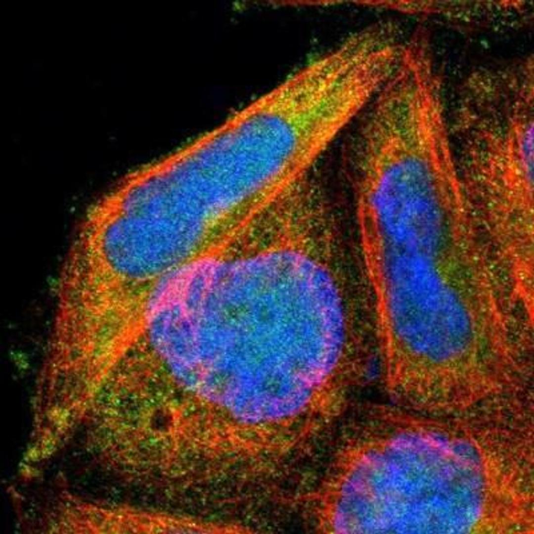 Immunocytochemistry/Immunofluorescence: UCH37 Antibody [NBP1-85656] - Staining of human cell line A-431 shows positivity in nucleus & cytoplasm.