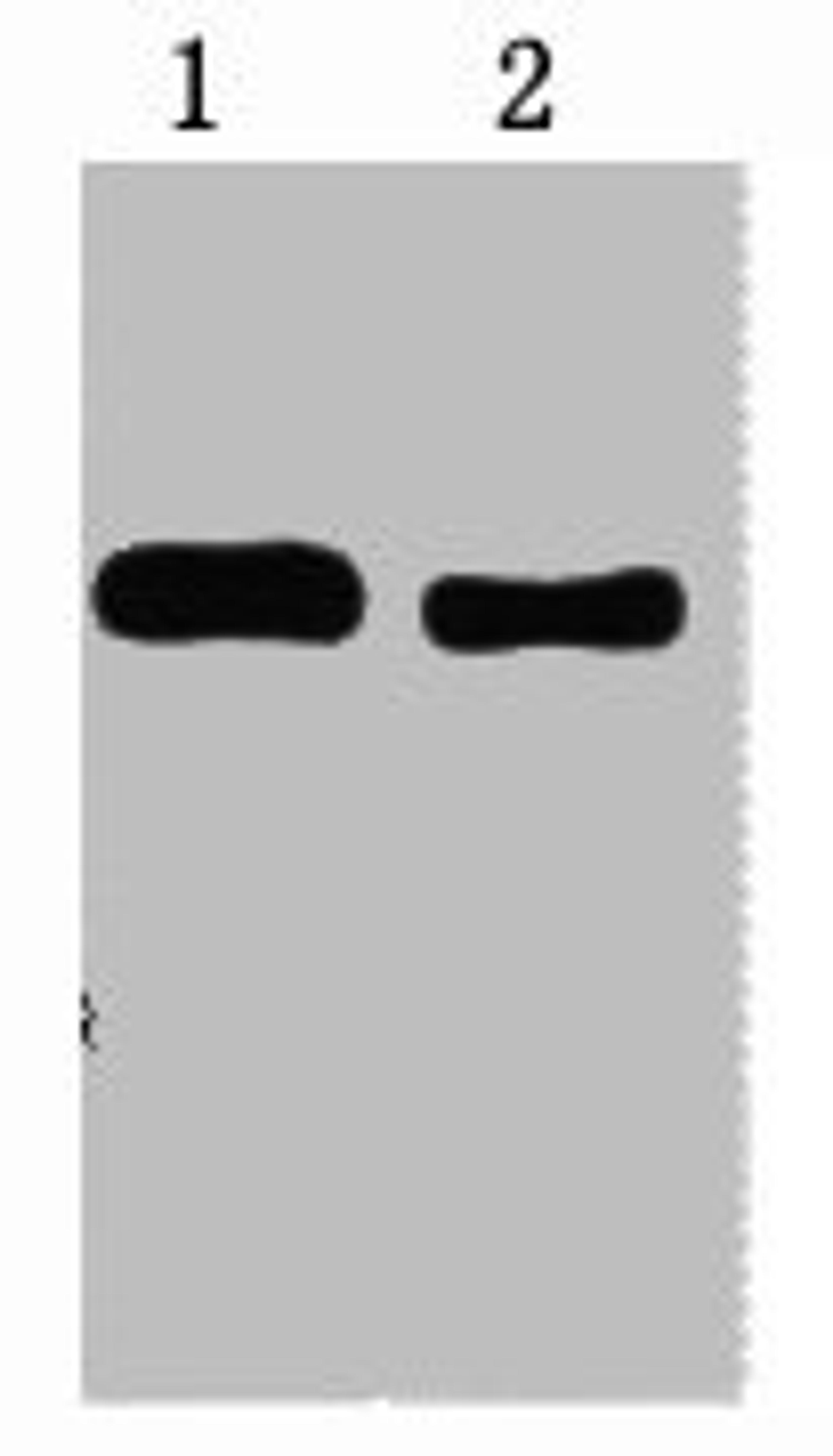 1ug Trx fusion protein+ Primary antibody dilution at 1) 1:5000 2) 1:10000