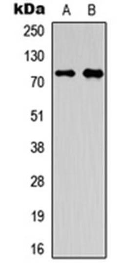 Western blot analysis of HepG2 (Lane1), A549 (Lane2) whole cell using OLFML2A antibody