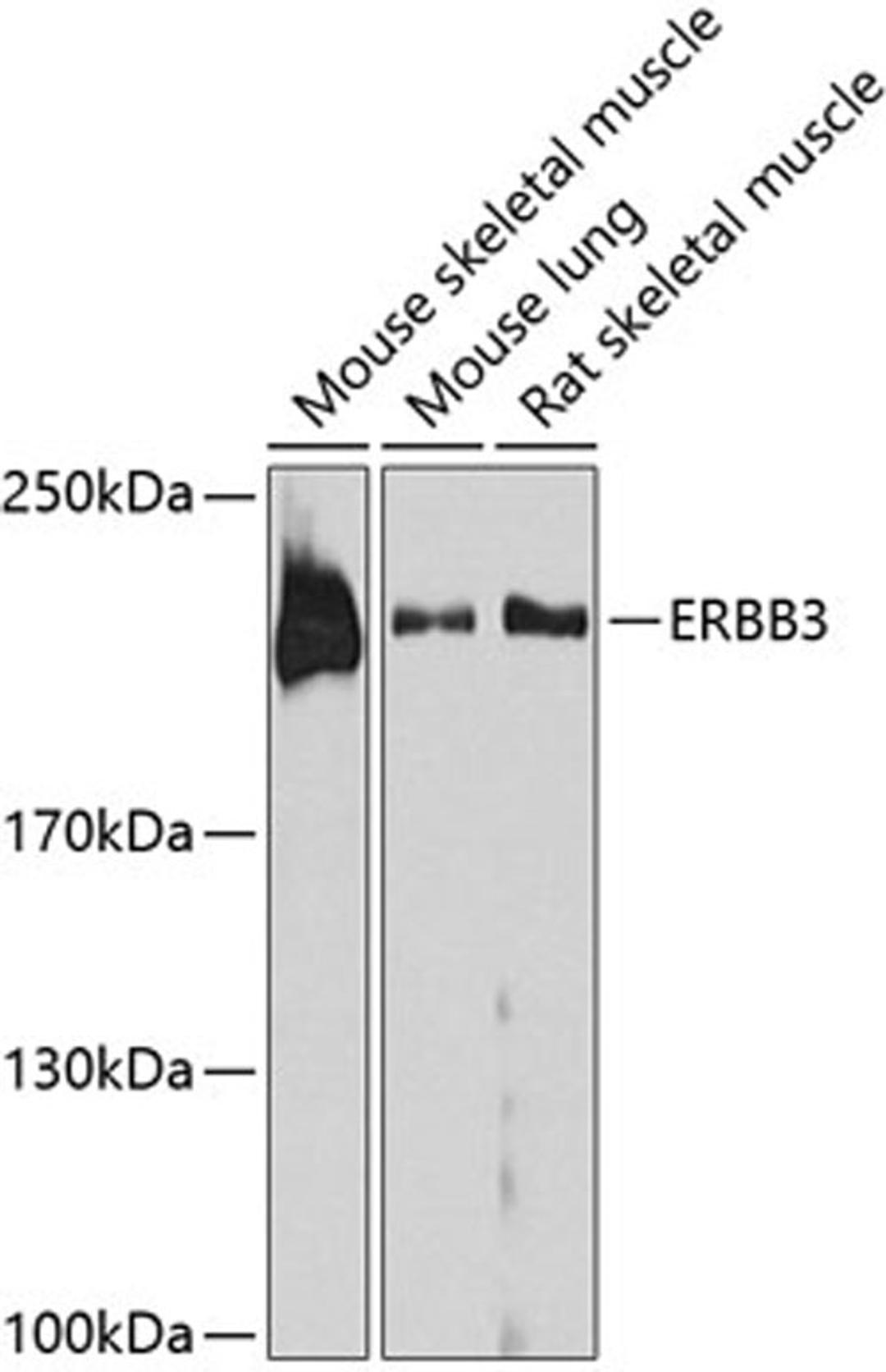 Western blot - ERBB3 antibody (A0950)