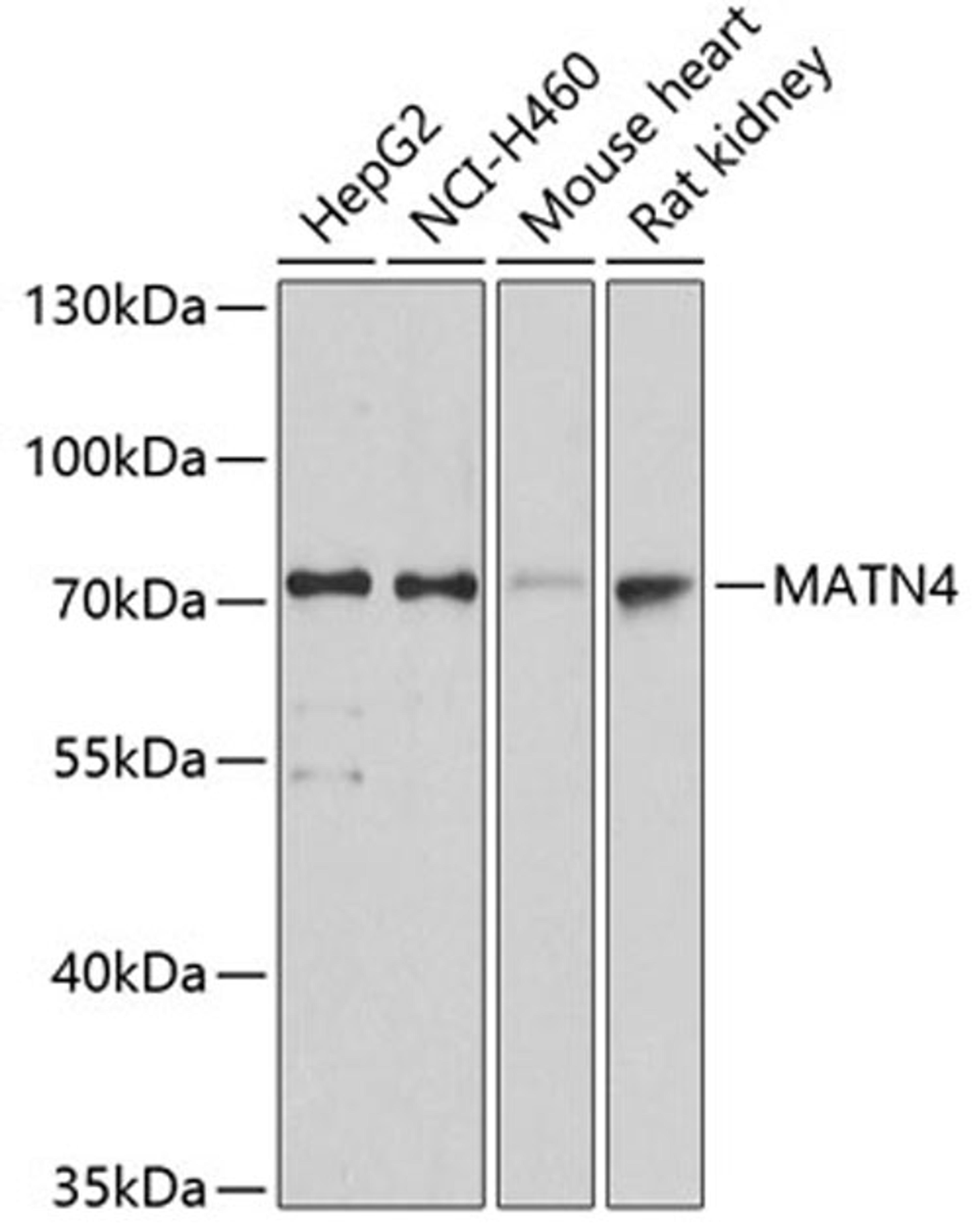 Western blot - MATN4 antibody (A2761)