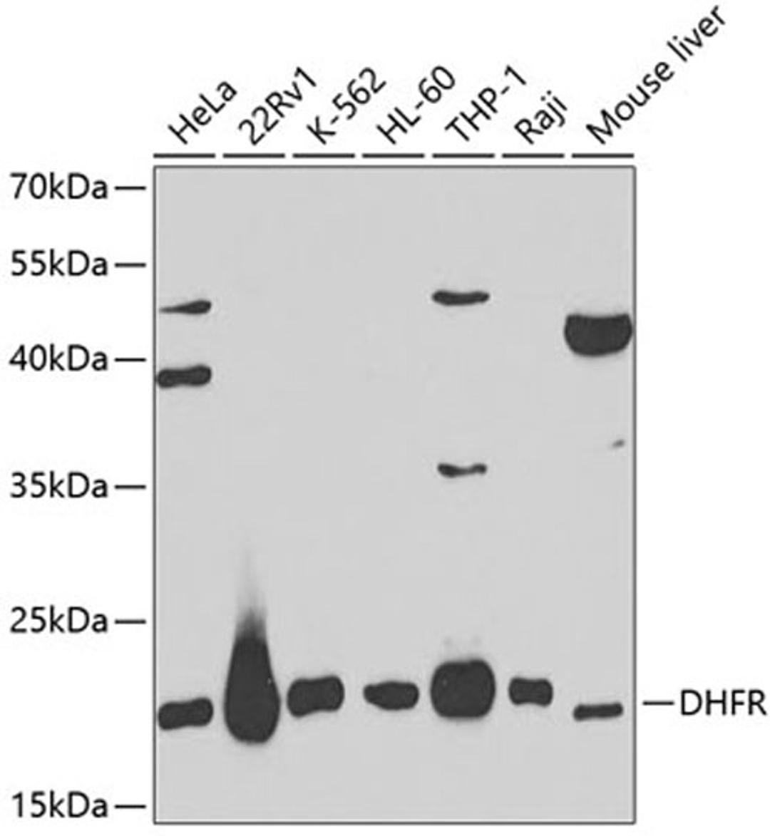 Western blot - DHFR antibody (A1607)