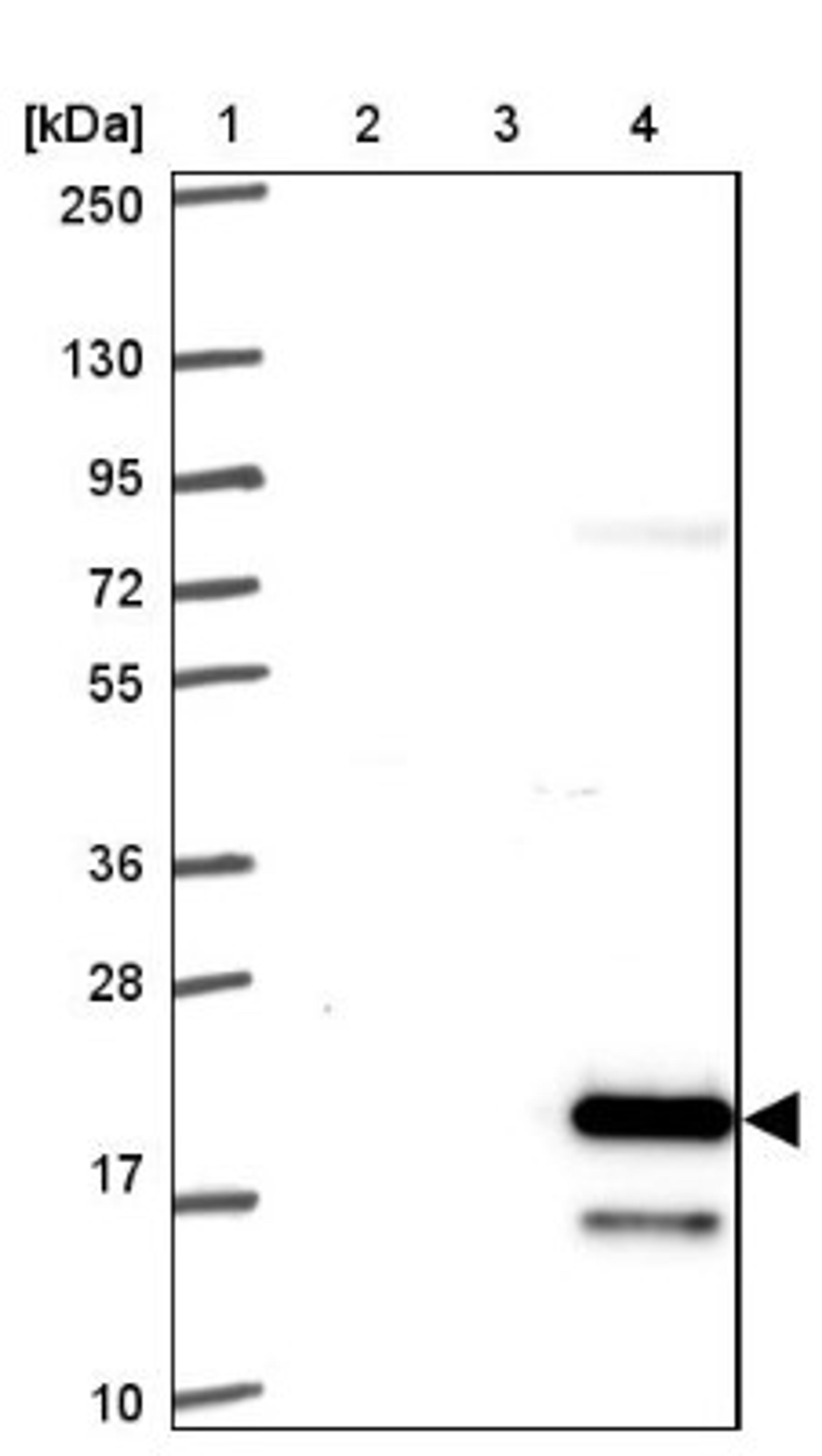 Western Blot: FAM195A Antibody [NBP2-32535] - Lane 1: Marker [kDa] 250, 130, 95, 72, 55, 36, 28, 17, 10<br/>Lane 2: Human cell line RT-4<br/>Lane 3: Human cell line U-251MG sp<br/>Lane 4: Human plasma (IgG/HSA depleted)