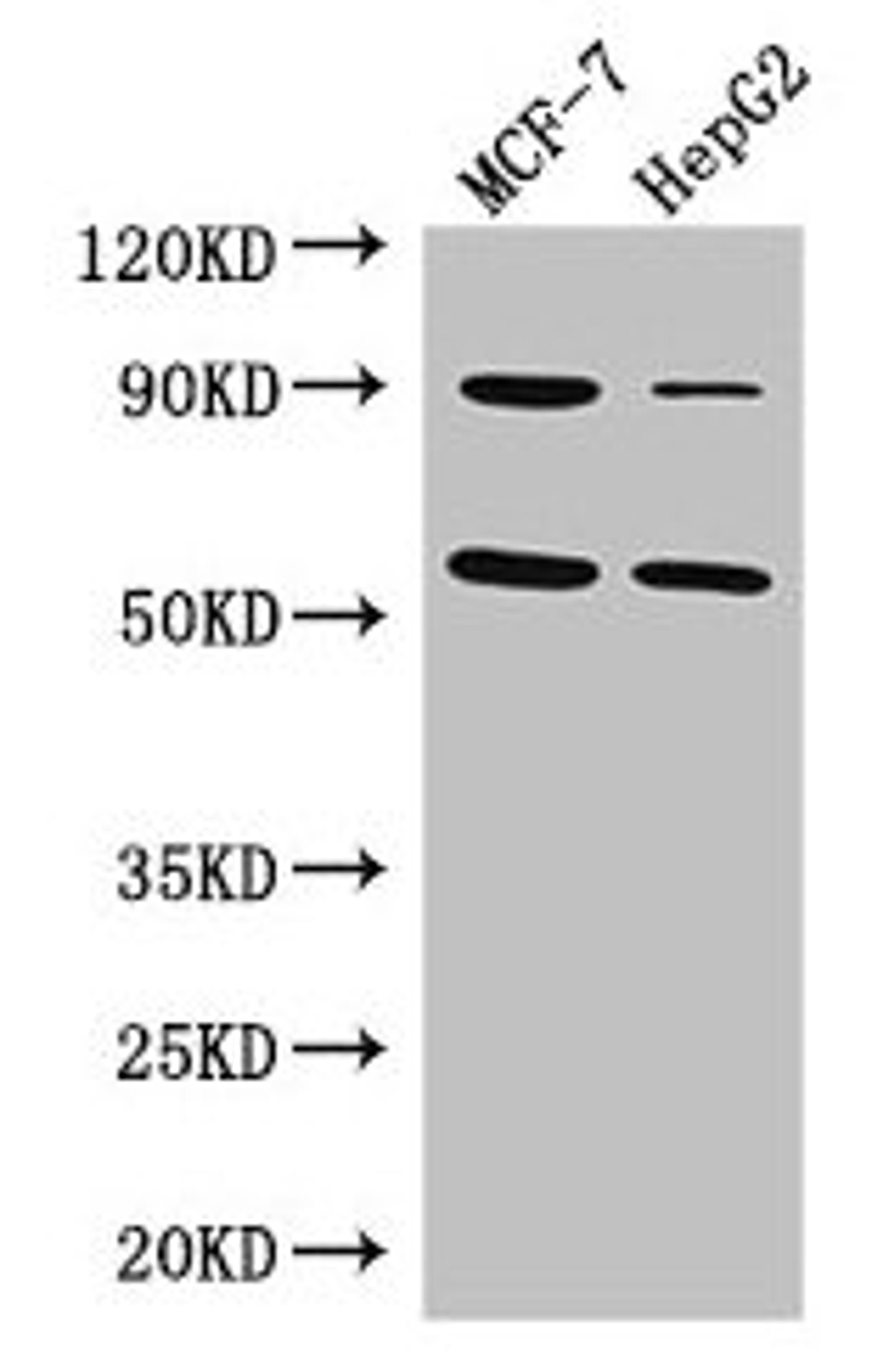 Western Blot. Positive WB detected in: MCF-7 whole cell lysate, HepG2 whole cell lysate. All lanes: FOXC1 antibody at 3µg/ml. Secondary. Goat polyclonal to rabbit IgG at 1/50000 dilution. Predicted band size: 57 kDa. Observed band size: 57 kDa