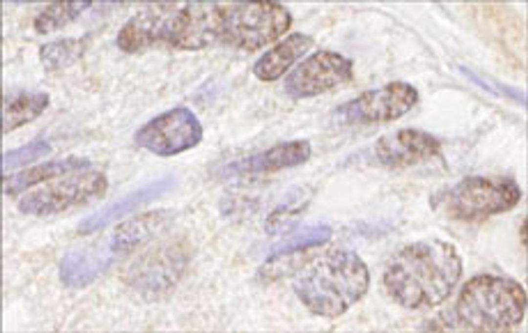 Detection of human ATM by immunohistochemistry.