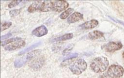 Detection of human ATM by immunohistochemistry.